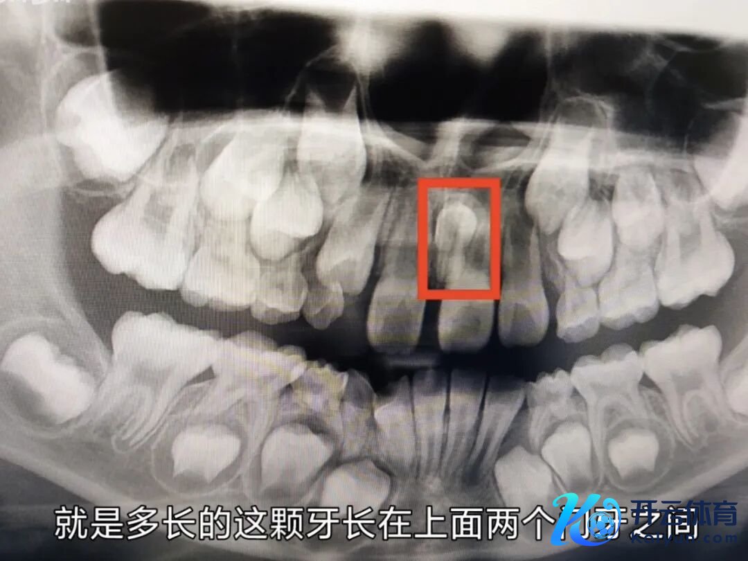 ebc698f0-d1d4-418b-a196-9a554b10ee8d.jpg